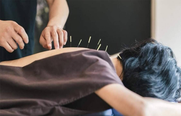 Điện châm điều trị Rối loạn mãn kinh và rối loạn tiền mãn kinh (Kinh loạn)